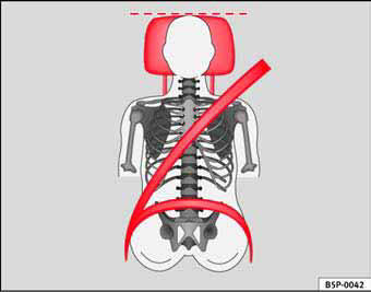 Fig. 3 Apoyacabezas ajustado correctamente visto de frente